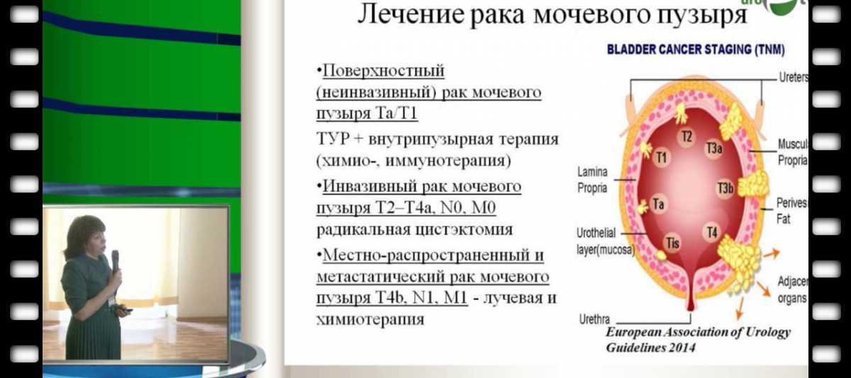 Нарушения минерального обмена в почках (дисметаболические нефропатии)