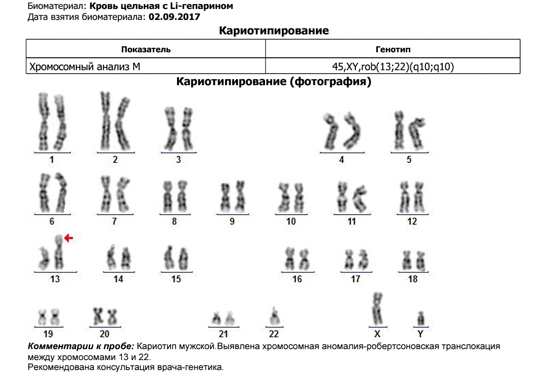 Кариотипирование супругов: показания, подготовка к анализу / mama66.ru