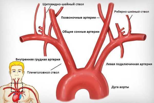 Схема брахиоцефальных сосудов