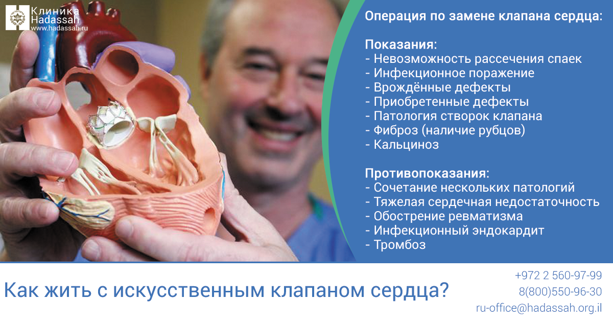 Митральный клапан после операции. Протез аортального клапана. Операция на клапан сердца. Протез митрального клапана.