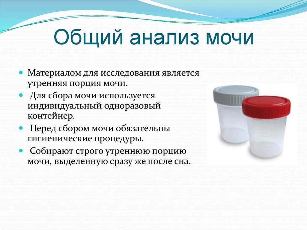 Общий анализ мочи – результаты, стандарты, расшифровка, причины отклонений