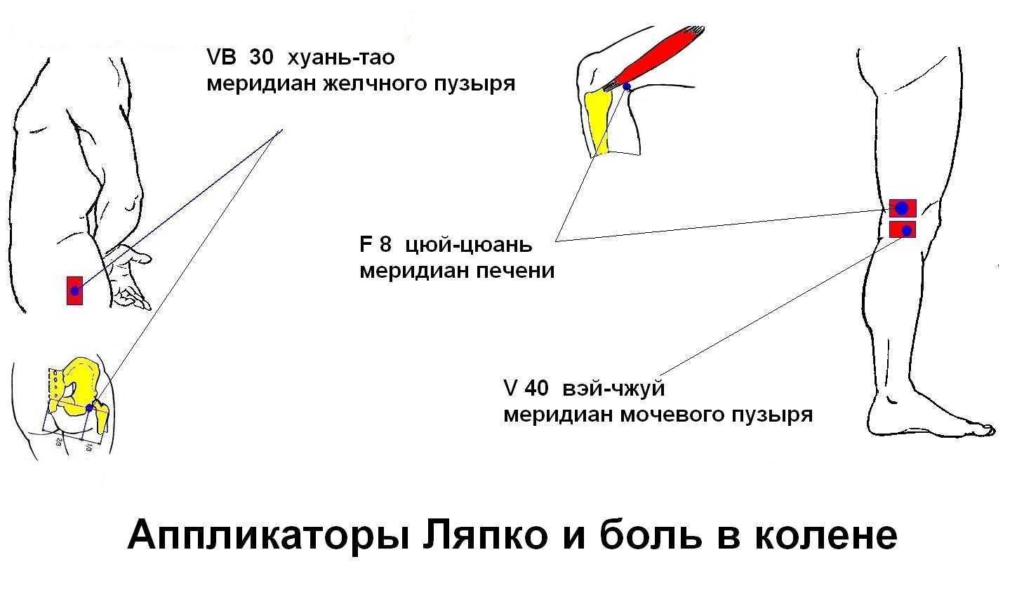 Дифференциальная диагностика боли в тазобедренном суставе | kinesiopro
