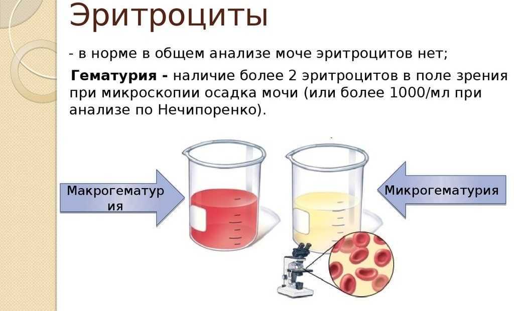 Моча и месячные выходят схема откуда