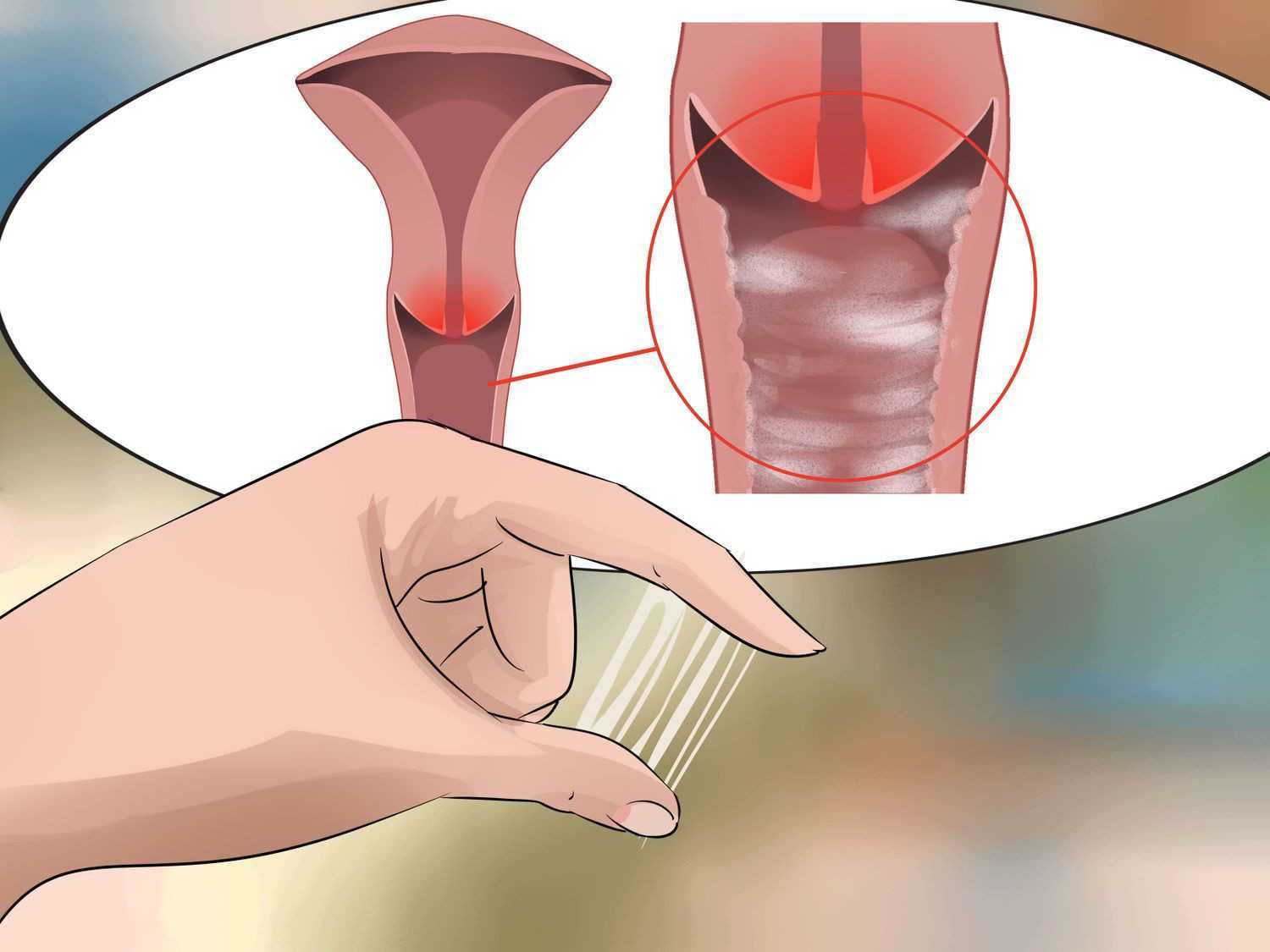выделения спермы у мужчин причины фото 116