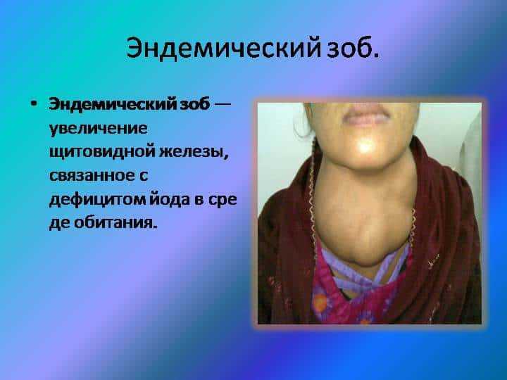 За что отвечает щитовидная железа?