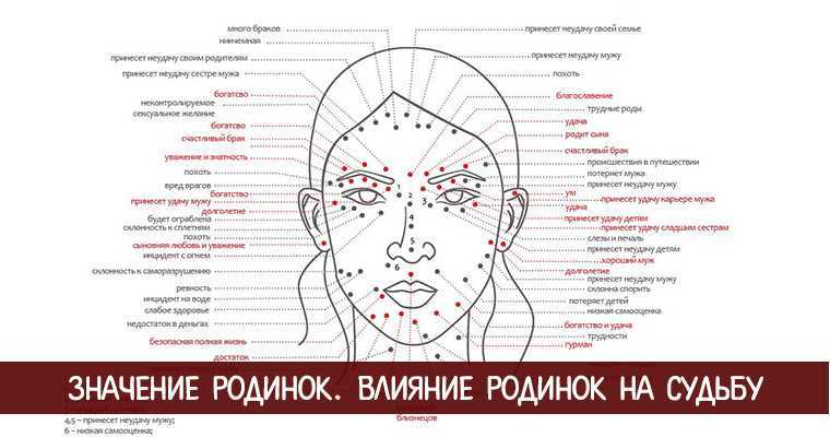 Удаление родинок на теле - с чего начать, к кому врачу нужно обратиться и каким методом лучше всего удалять.
