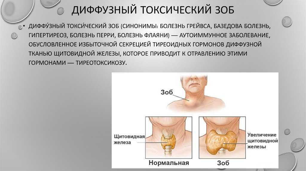Доброкачественные образования печени